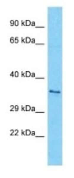 OR7A17 Rabbit anti-Human, Polyclonal, Novus Biologicals 100 &mu;g; Unconjugated:Antibodies,